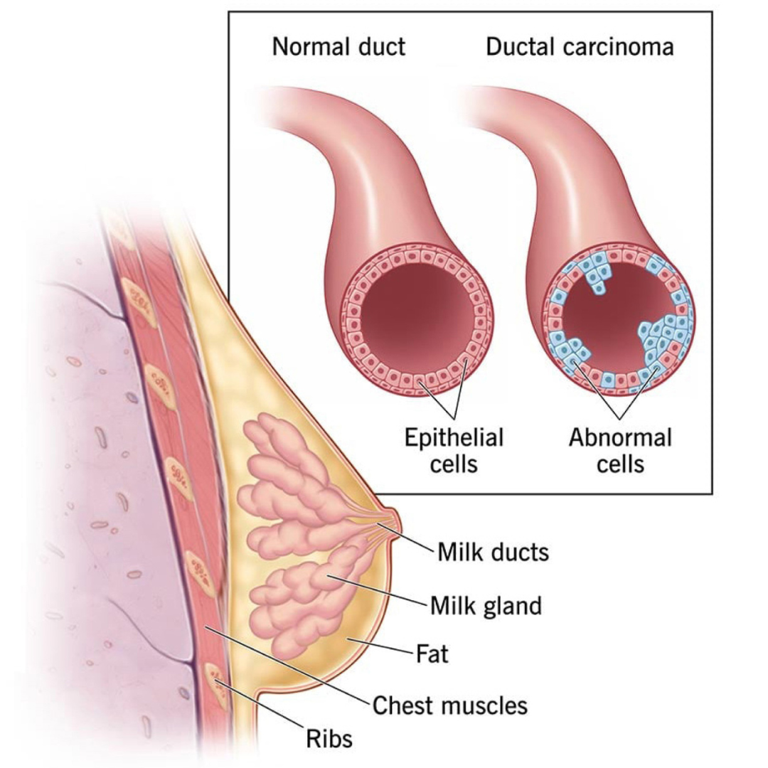global ultrasound breats care clinic